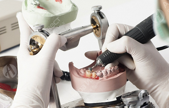 Производство зубных протезов с контрактами Фото - 1